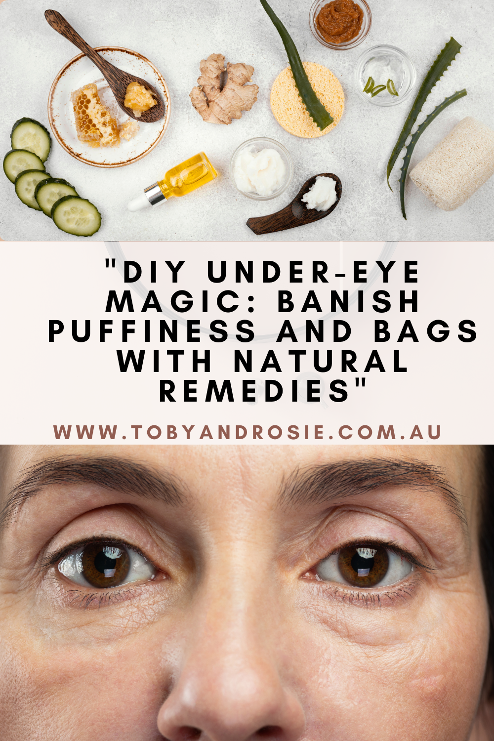 Best Natural Remedies for Under-Eye Puffiness and Bags